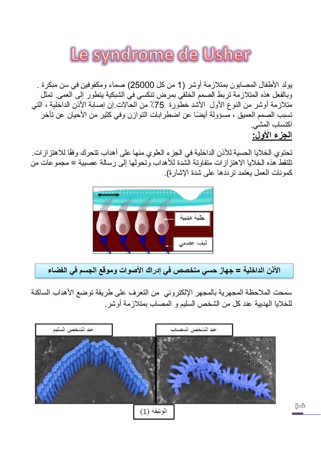 تمرين حول متلازمة أوشر في مادة العلوم الطبيعية للأستاذ حيمر 3 ثانوي